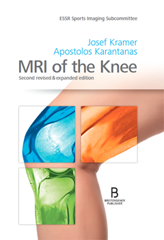 MRI of the Knee 2
